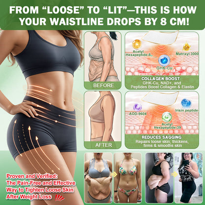 𝑶𝒇𝒇𝒊𝒄𝒊𝒂𝒍 𝑺𝒕𝒐𝒓𝒆 |🍀𝐀𝐌𝐙𝐊𝐄𝐄𝐏® 𝑴𝒆𝒕𝒂𝒃𝒐𝒍𝒊𝒄 𝑵𝒂𝒏𝒐 𝑴𝒊𝒄𝒓𝒐𝒏𝒆𝒆𝒅𝒍𝒆 𝑷𝒂𝒕𝒄𝒉🇺🇸(𝐉𝐮𝐬𝐭 𝐨𝐧𝐜𝐞 𝐚 𝐝𝐚𝐲, 𝐯𝐢𝐬𝐢𝐛𝐥𝐞 𝐜𝐡𝐚𝐧𝐠𝐞𝐬 𝐢𝐧 𝟕 𝐝𝐚𝐲𝐬）𝘽𝙚𝙧𝙗𝙚𝙧𝙞𝙣𝙚 + 𝙈𝙤𝙧𝙞𝙣𝙜𝙖 𝙁𝙤𝙧𝙢𝙪𝙡𝙖 ✅ 𝐅𝐨𝐫 𝐨𝐛𝐞𝐬𝐢𝐭𝐲, 𝗟𝗼𝗼𝘀𝗲 𝘀𝗸𝗶𝗻,𝐝𝐢𝐚𝐛𝐞𝐭𝐞𝐬, 𝐬𝐥𝐞𝐞𝐩 𝐚𝐩𝐧𝐞𝐚, 𝐣𝐨𝐢𝐧𝐭 𝐢𝐬𝐬𝐮𝐞𝐬, 𝐚𝐧𝐝 𝐦𝐨𝐫𝐞💯💯