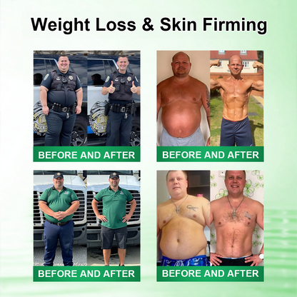 𝑶𝒇𝒇𝒊𝒄𝒊𝒂𝒍 𝑺𝒕𝒐𝒓𝒆  |🍀🍀𝐃𝐑.𝐇𝐎𝐍𝐎𝐑® 𝐋𝐲𝐦𝐩𝐡𝐚𝐭𝐢𝐜 𝐃𝐫𝐚𝐢𝐧𝐚𝐠𝐞 𝐒𝐥𝐢𝐦𝐦𝐢𝐧𝐠 𝐍𝐚𝐧𝐨-𝐌𝐢𝐜𝐫𝐨𝐧𝐞𝐞𝐝𝐥𝐞 𝐏𝐚𝐭𝐜𝐡🇺🇸(𝐉𝐮𝐬𝐭 𝐨𝐧𝐜𝐞 𝐚 𝐝𝐚𝐲, 𝐯𝐢𝐬𝐢𝐛𝐥𝐞 𝐜𝐡𝐚𝐧𝐠𝐞𝐬 𝐢𝐧 𝟕 𝐝𝐚𝐲𝐬）𝘽𝙚𝙧𝙗𝙚𝙧𝙞𝙣𝙚 + 𝙈𝙤𝙧𝙞𝙣𝙜𝙖 𝙁𝙤𝙧𝙢𝙪𝙡𝙖 ✅ 𝐅𝐨𝐫 𝐨𝐛𝐞𝐬𝐢𝐭𝐲, 𝗟𝗼𝗼𝘀𝗲 𝘀𝗸𝗶𝗻,𝐝𝐢𝐚𝐛𝐞𝐭𝐞𝐬, 𝐬𝐥𝐞𝐞𝐩 𝐚𝐩𝐧𝐞𝐚, 𝐣𝐨𝐢𝐧𝐭 𝐢𝐬𝐬𝐮𝐞𝐬, 𝐚𝐧𝐝 𝐦𝐨𝐫𝐞💯💯